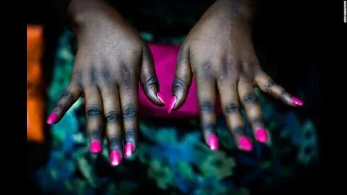 How To Get Your Orignal Skin Back After Bleaching