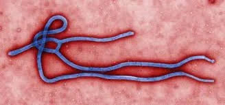 ebola virus.jpg ebola virus.jpg