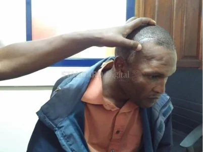 samuel head scar.JPG
