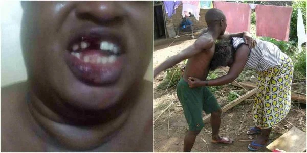 Laila’s Blog-Sex worker teeth.jpg Laila’s Blog-Sex worker teeth.jpg
