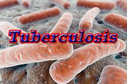 Tuberculosis.png Tuberculosis.png
