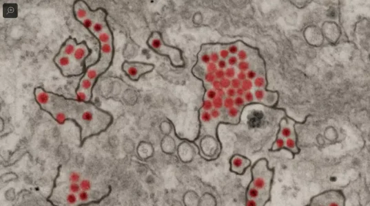 Virus.PNG Virus.PNG