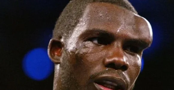sport injuries.JPG sport injuries.JPG