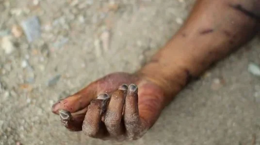 Dead-hand.jpg Dead-hand.jpg