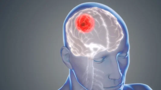 Brain-CancerGlioblastoma-1062x598.jpg Brain-CancerGlioblastoma-1062x598.jpg