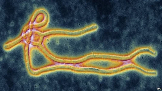ebola virus.jpg ebola virus.jpg