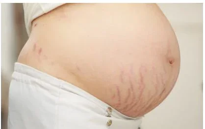 pregnancy.JPG pregnancy.JPG