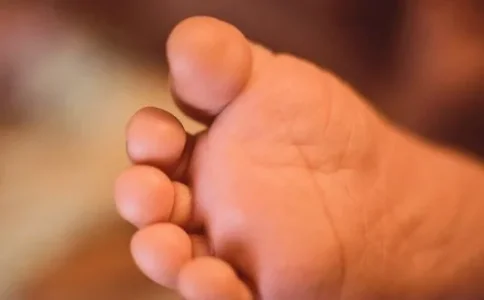 leg.JPG leg.JPG