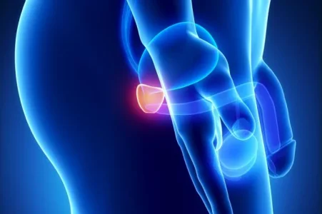 prostate-cancer.jpg
