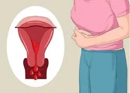 menstruation.jpg