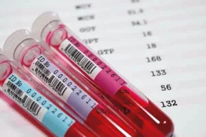 Blood-samples.jpg Blood-samples.jpg
