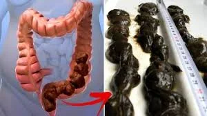 colon.jpg
