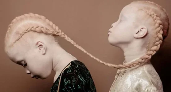 albino.JPG