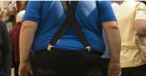 obesity.JPG obesity.JPG