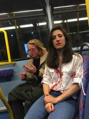 wounded.jpg