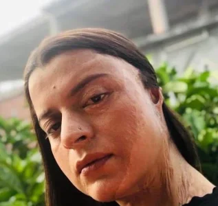 acid.JPG