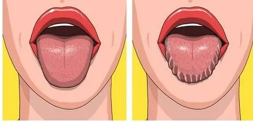 tounge.JPG