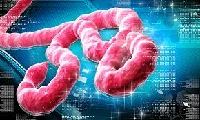 ebola viruss.jpg ebola viruss.jpg