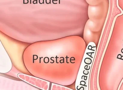 prostate.JPG prostate.JPG