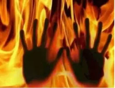 burn.JPG burn.JPG