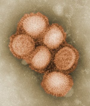 First-Ever Swine Flu Case Hits UK -What You Need to Know
