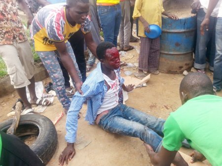 PIC.-13.-VICTIM-OF-A-MULTIPLE-ACCIDENT-IN-ABUJA-1024x768.jpg