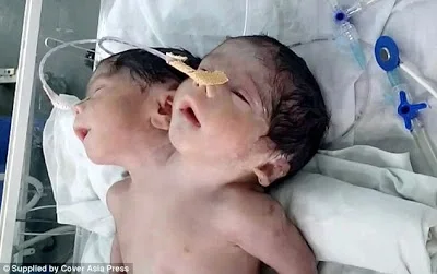 2 HEAD BABY 3.jpg