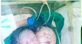 two head baby 3.PNG two head baby 3.PNG